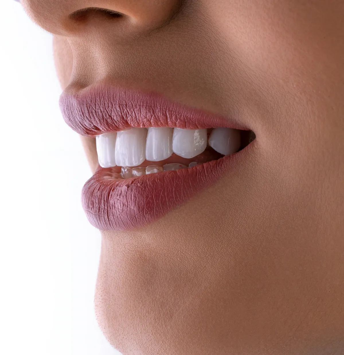 Sorriso com dentes brancos e alinhados (foto de amostra)