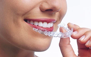 Sorriso com um alinhador transparente na mão (foto de amostra)